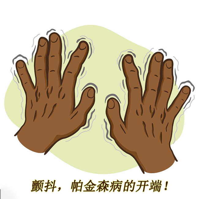 顫抖，帕金森病的開端 帕金森的早期癥狀