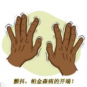 顫抖，帕金森病的開端 帕金森的癥狀有哪些